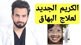 علاج البهاق الجديد 4 عيوب في هذا الكريم - دكتور طلال المحيسن