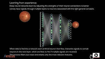 Pradeep Walia | Solving Diabetic Retinopathy with Artificial Intelligence