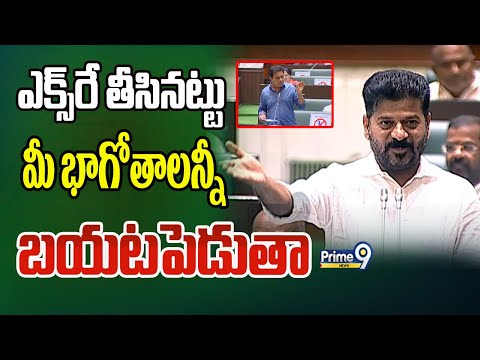 CM Revanth Reddy Serious On KTR In Assembly :ఎక్స్ రే తీసినట్టు మీ భాగోతాలన్నీ బయటపెడుతా