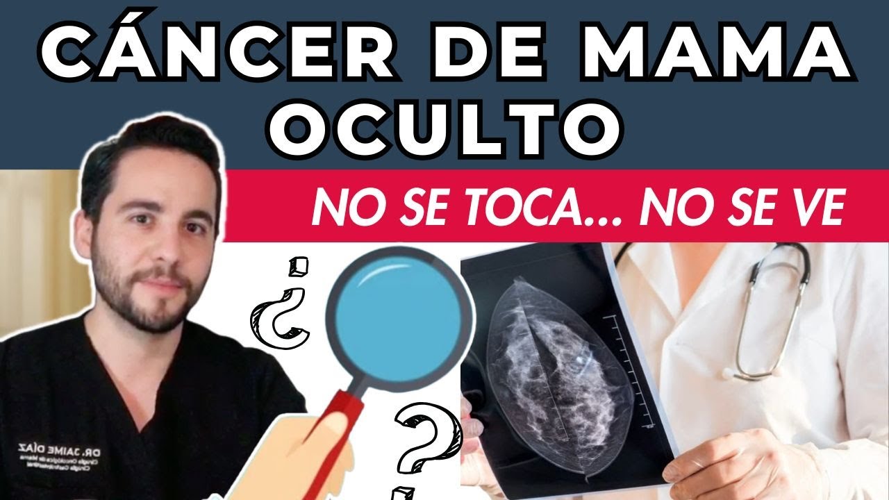 CÁNCER DE MAMA OCULTO - Un reto para diagnóstico y tratamiento