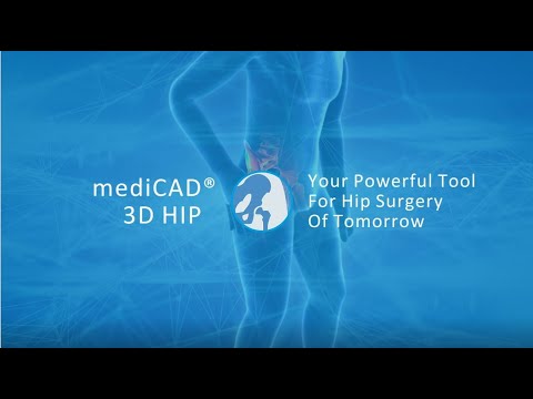 mediCAD 3D Hip - YouTube
