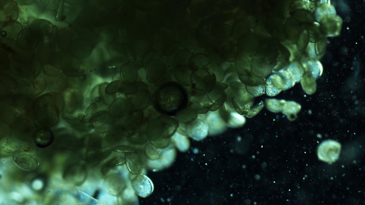 conglutinate full of glochidia from a female Spike (Elliptio dilatata) mussel