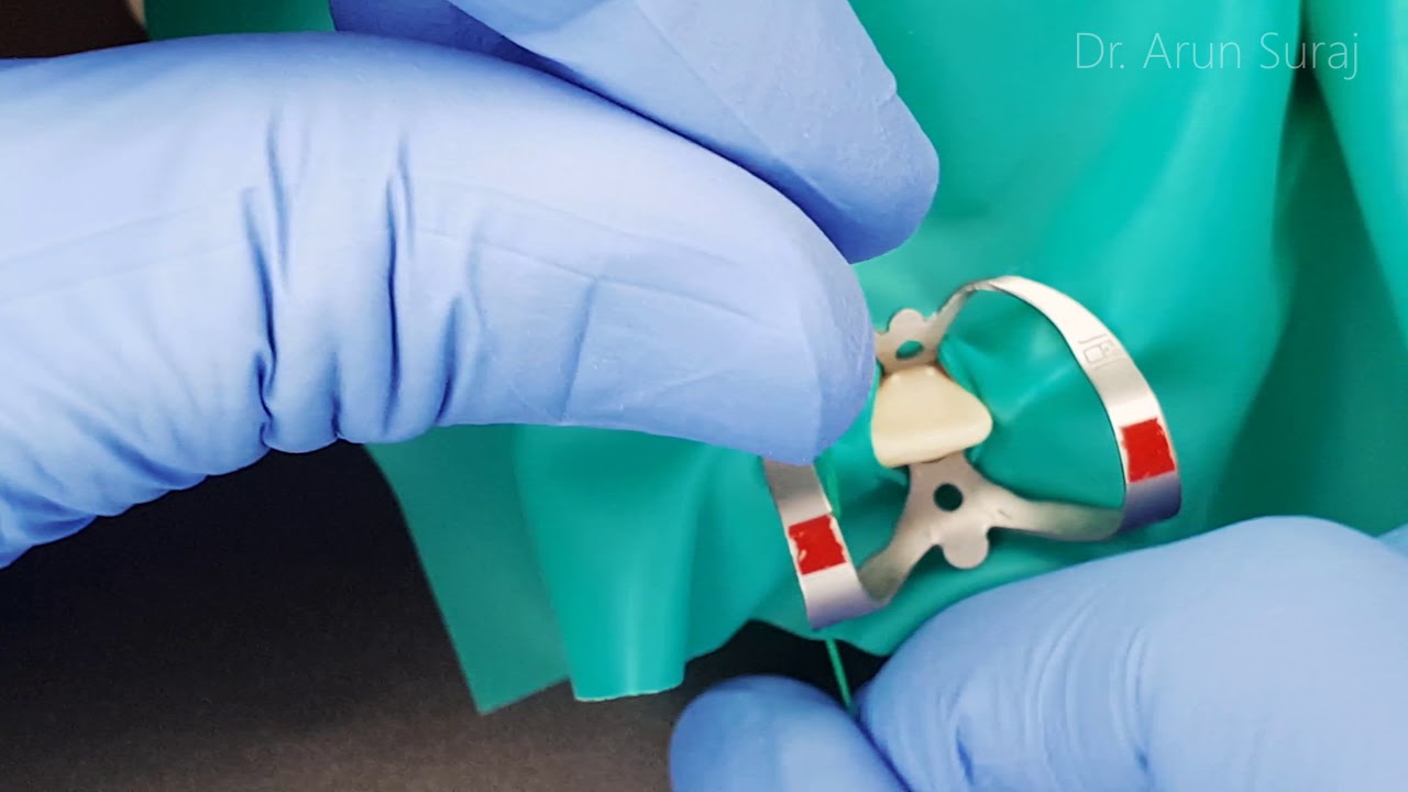 Rubber dam isolation of an anterior tooth. Dental Clinic