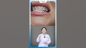 Sử Dụng Bàn Chải Kẽ Như Nào Là Đúng | Nha Khoa Minh Châu