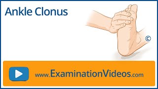 Ankle Clonus