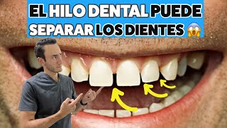 ¿El hilo dental te provoca sangrado de encía y separa tus dientes? Cómo evitarlo.