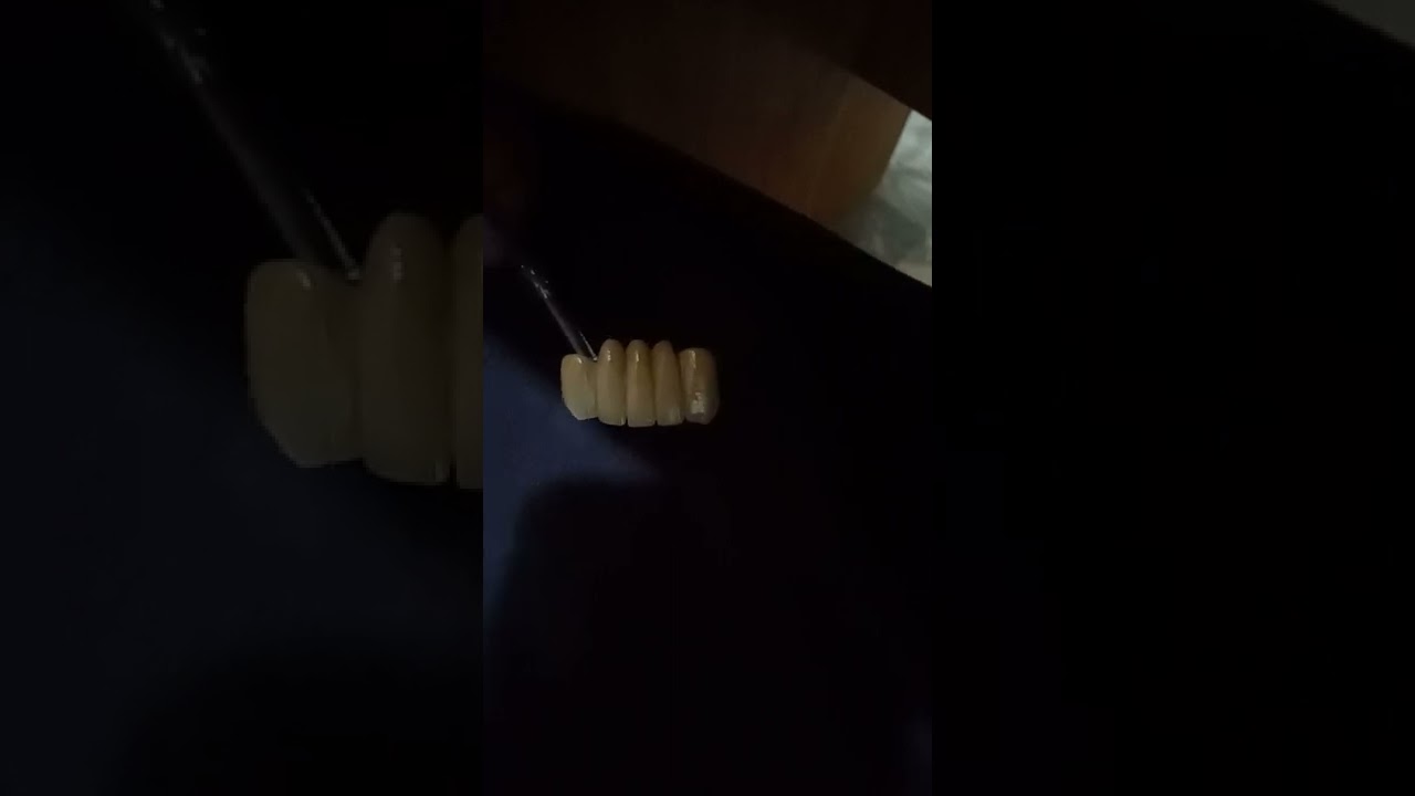 alshifa dental lab lahore vita mx 03004703223 YouTube