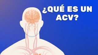 ¿Qué son los accidentes cerebrovasculares o ACV?