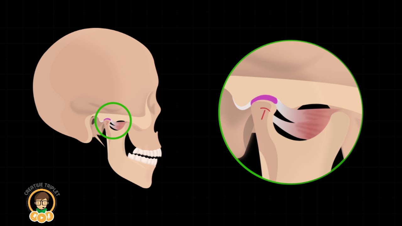 Tmj Opening Animation TMJ Pain I Medical Animation by Creative Triplet - YouTube