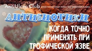 Трофическая язва - это не значит, что нужны антибиотики. А вот когда они необходимы, я вам расскажу.