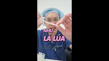 CÁCH BÁC SĨ QUANG CHỌN SỤN NÂNG MŨI | BS Nguyễn Duy Quang