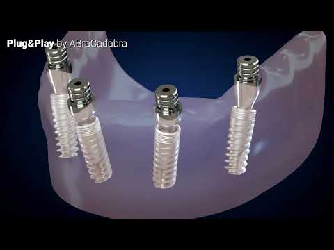 ABraCadabra Plug & Play Restorative Concept