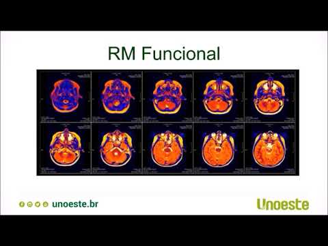 Vídeo: Melhorando A Reprodutibilidade Funcional Da Ressonância Magnética