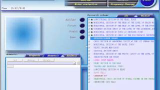 latest English software professional 3D NLS health analyzer operation video