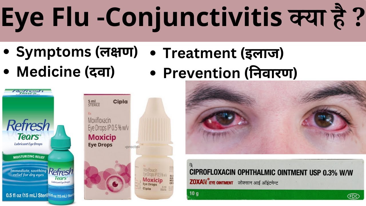 Eye flu (Conjunctivitis) Types, Treatment (Ilaj), Medicine (Eye drop