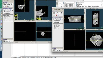 HistoloZee Tutorial 15 - Manual 3D alignment of two MR images (part 1)
