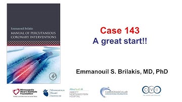 Case 143: PCI Manual - A great start!!