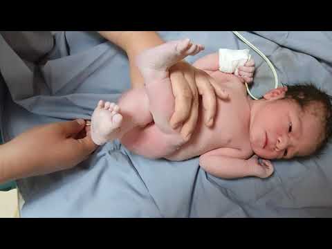 valoración del recién nacido