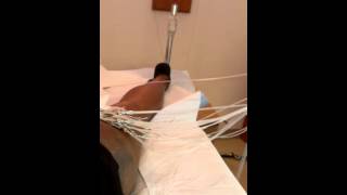 Brachytherapy Radiation
