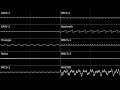 The Lesser-Tron - Original Composition - FamiTracker 2A03+VRC6+MMC5 Phase 2 Cover