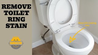 Remove Toilet Ring and Hard Water Stains From Your Toilet