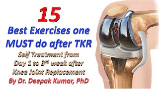 15 Best Self Treatment Exercises after Total Knee Replacement Surgery | TKR | Physiotherapy at Home