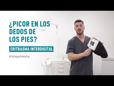 Video: ¿Picazón entre los dedos de los pies?