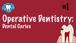 Operative Dentistry | Dental Caries | INBDE, ADAT