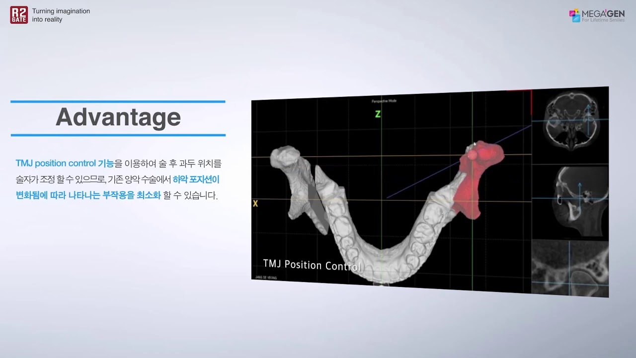 [Step5] TMJ position control vr (KR)