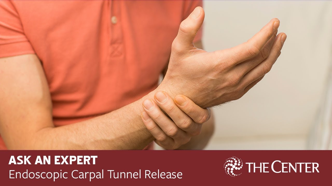 endoscopic-carpal-tunnel-release-youtube
