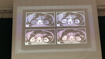 CT HỆ TIẾT NIỆU