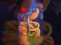 How castric bypass surgery Helps ou Lose Weiaht & Chande Your Life NI E(3D Animation)#gastricbypass