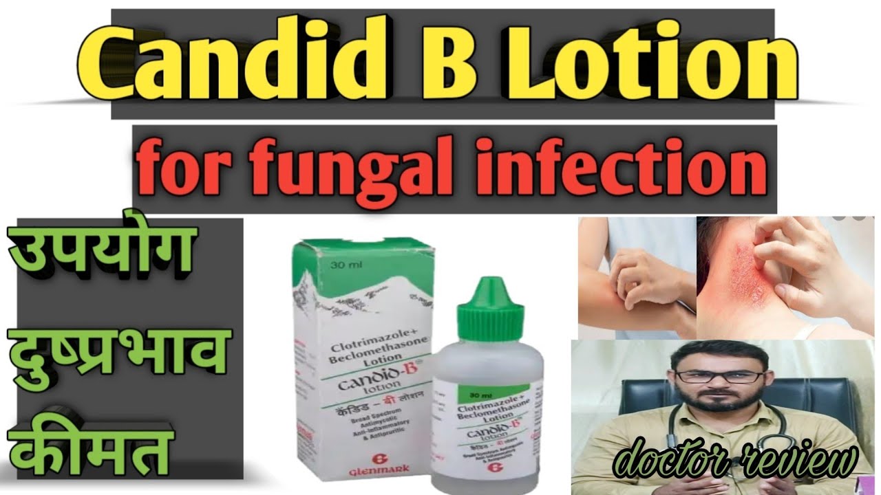B Tax Cream Uses In Hindi Candid B Lotion Uses Hindi - fitriblog1