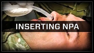 Inserting a Nasopharyngeal Airway (NPA)