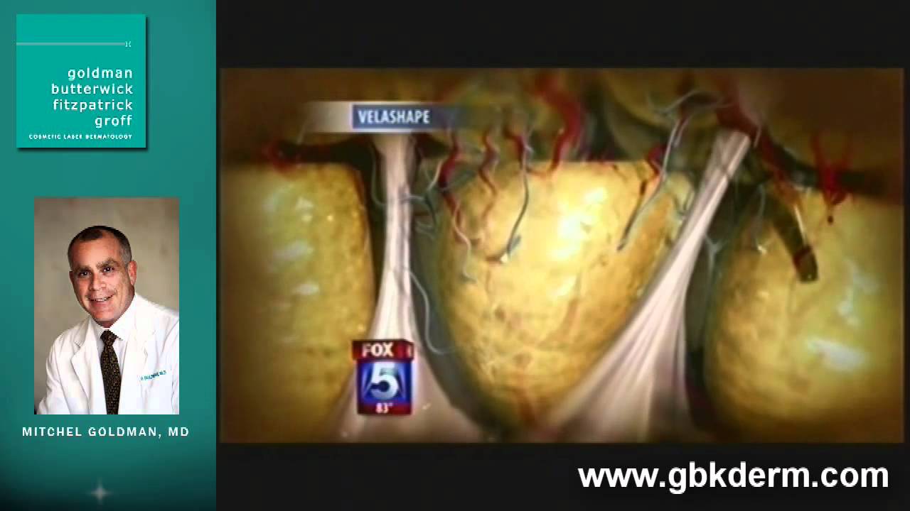 Banner for Cellulite Treatments With Dermatologist Dr Goldman