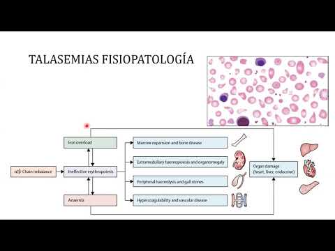 Clase 23 y 24 - Anemias Hemolíticas Intracorpusculares 2da parte y autoinmune