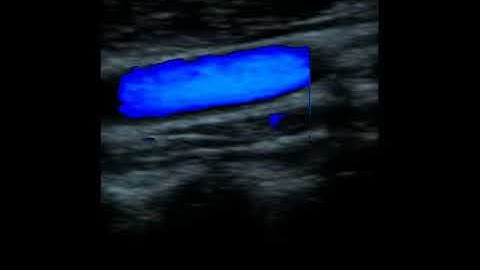 Kaixin DCU 10 color doppler ultrasound