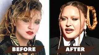 Madonna s plastic surgery the TRUTH Opt into Beauty