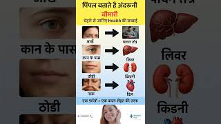 पपल बतत ह अदरन बमर चहर स जनए Health क सचचई Pimples Causes & Face Mapping