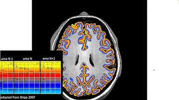 layer fMRI: the principles behind it and a few applications. Renzo Huber