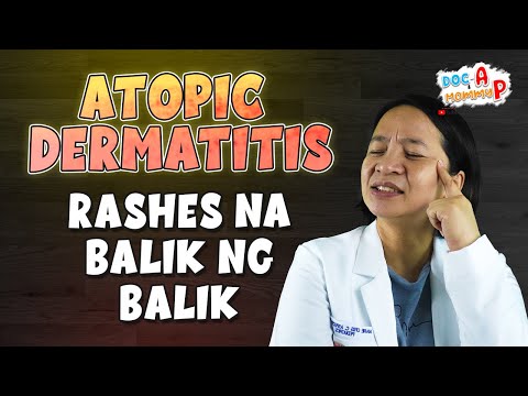 RASHES ng bata na BALIK NG BALIK at HINDI GUMAGALING || Atopic Dermatitis || Doc-A Pediatrician