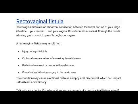 Video: Fistula Rektovaginal - Gejala Dan Rawatan, Diagnosis