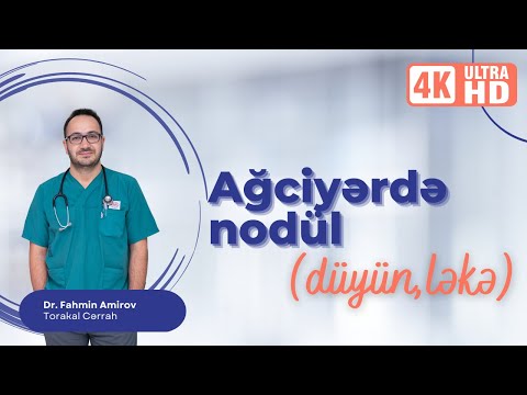 Ağciyərdə nodül. Ağciyərdə nodülün yaranma səbəbi nədir?