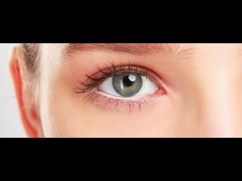 الأستيجماتيزم - اللانقطية - اللابؤرية - الإنحراف Astigmatism