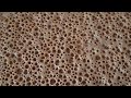 Injera Injera