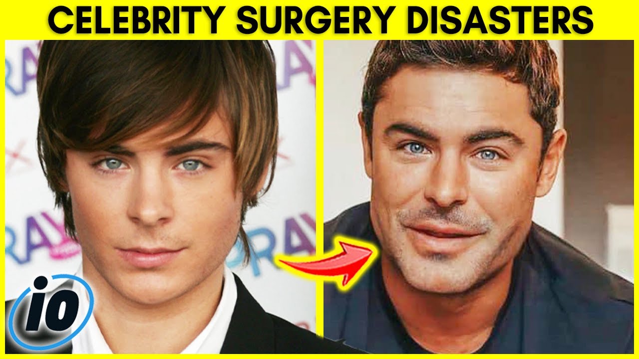 Top 10 Celebrity Plastic Surgery Disasters Youtube