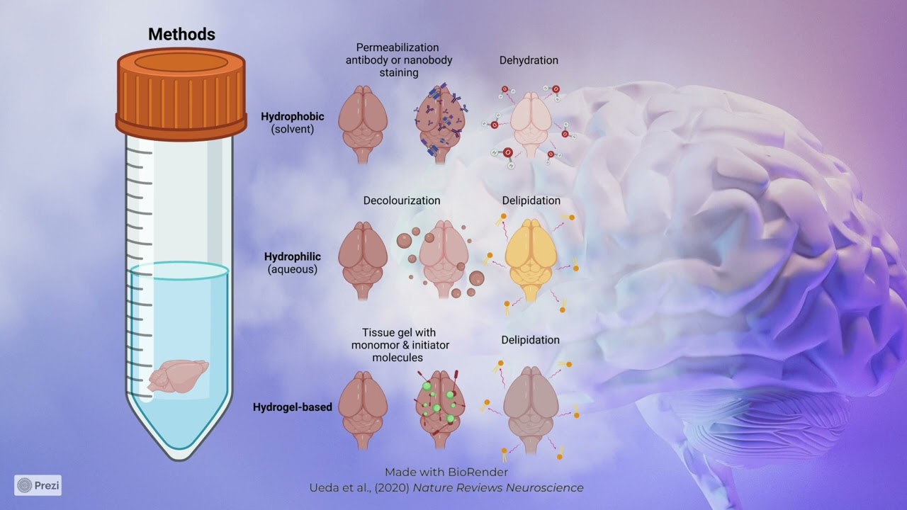 I Can See Clearly Now, The Brain is Gone YouTube