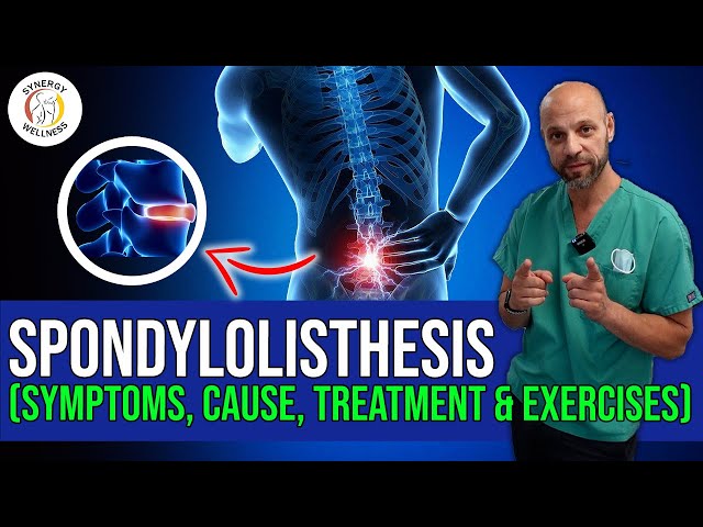 Spondylolisthesis (Symptoms, Cause, Treatment & Exercises) class=