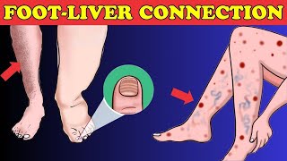 Body Alert: What Your Feet Say About Your Liver Condition! | Healthy Care