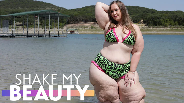 People Call Me 'Fat' - But I'm Proud Of My Lymphed...